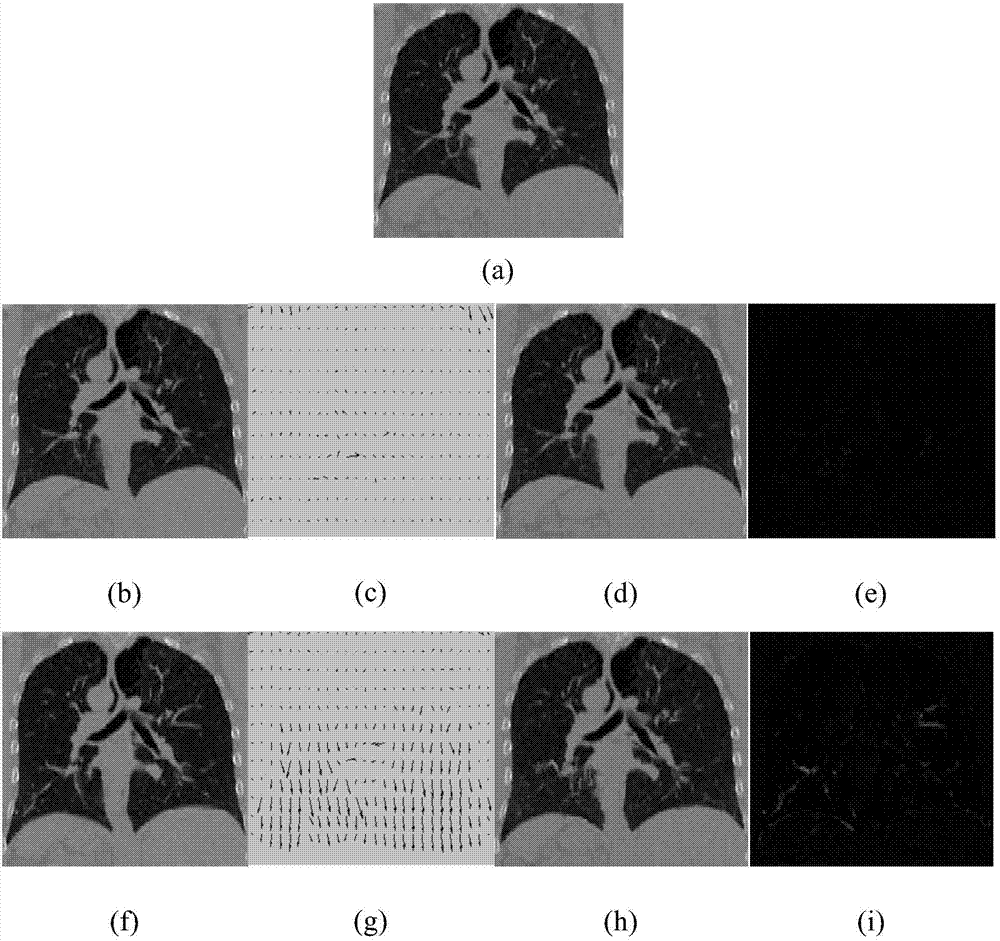 Lung 4D-CT image super-resolution processing method based on variational optical flow estimation