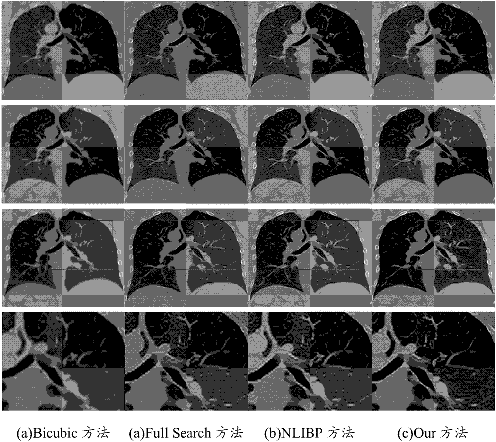 Lung 4D-CT image super-resolution processing method based on variational optical flow estimation