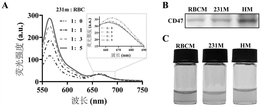 Particle size variable anti-tumor bionic nano preparation based on PLGA and preparation method and application thereof