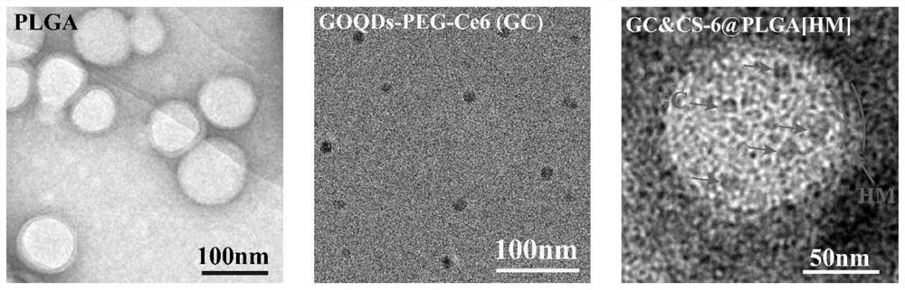 Particle size variable anti-tumor bionic nano preparation based on PLGA and preparation method and application thereof