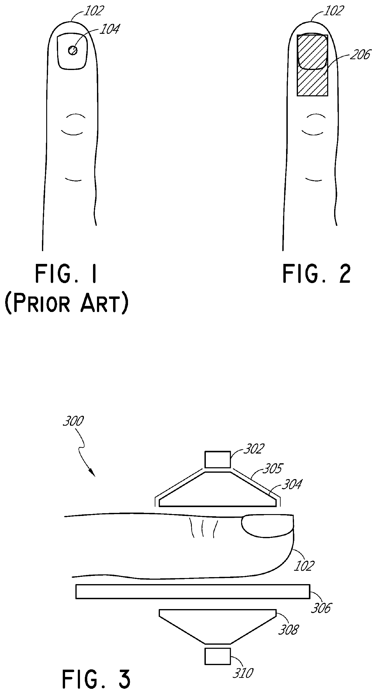 Physiological monitoring devices, systems, and methods