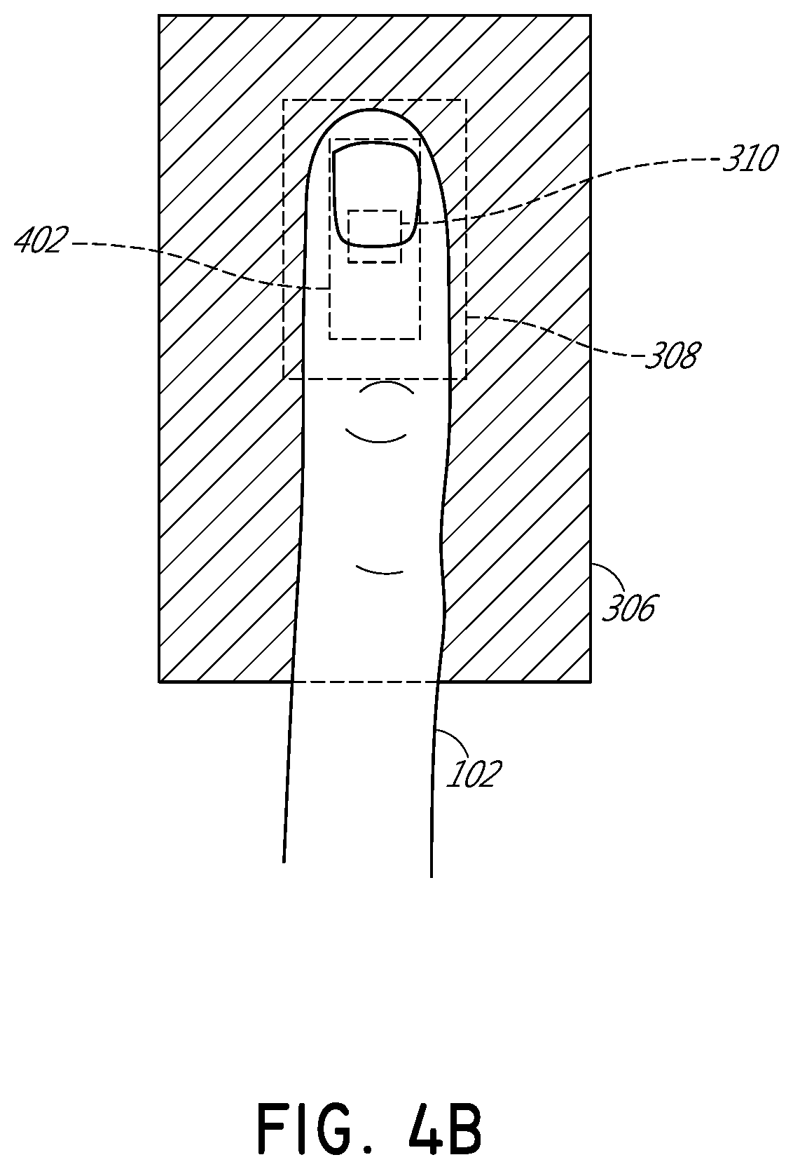 Physiological monitoring devices, systems, and methods