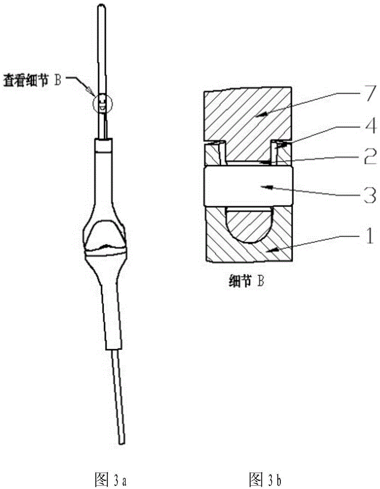 Tumor type knee joint prosthesis intramedullary needle