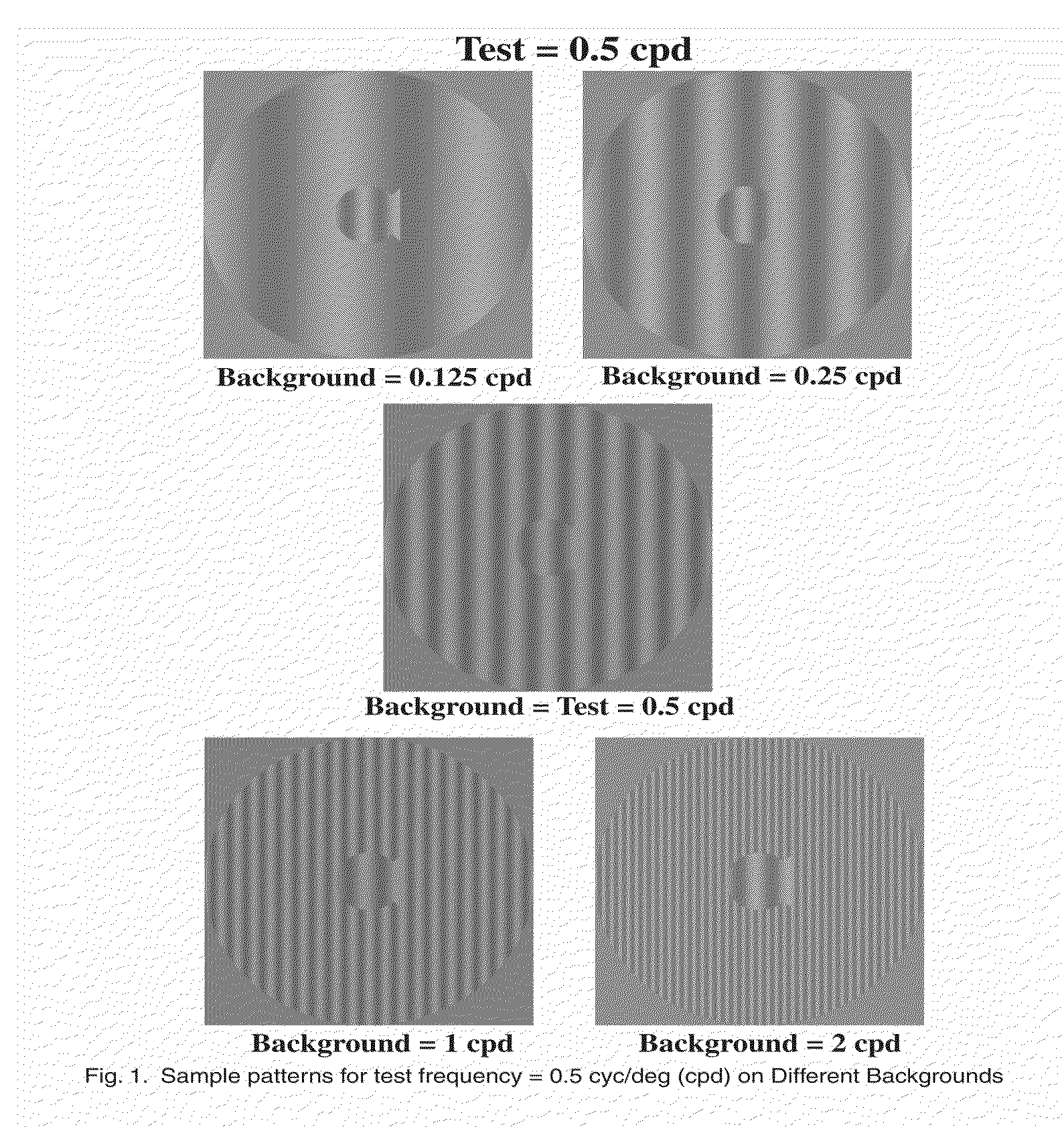 Diagnosing and remediating cognitive deficits involving attention, sequential processing, reading, speed of processing, and navigation