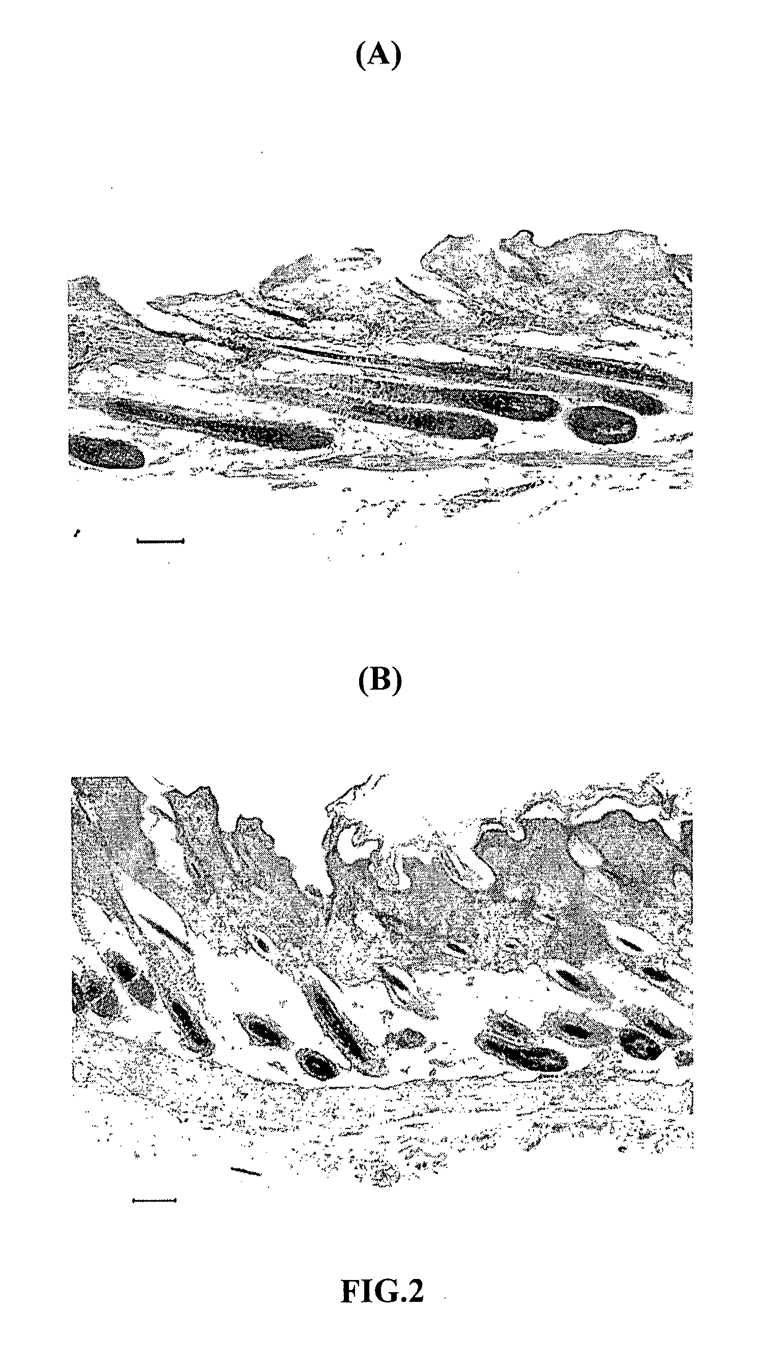 Method For Stimulating Hair Growth And Regeneration