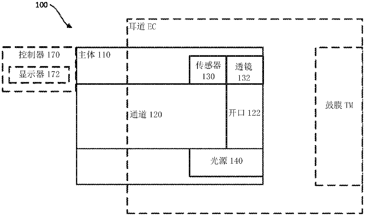 Visualization devices and methods for otologic procedures