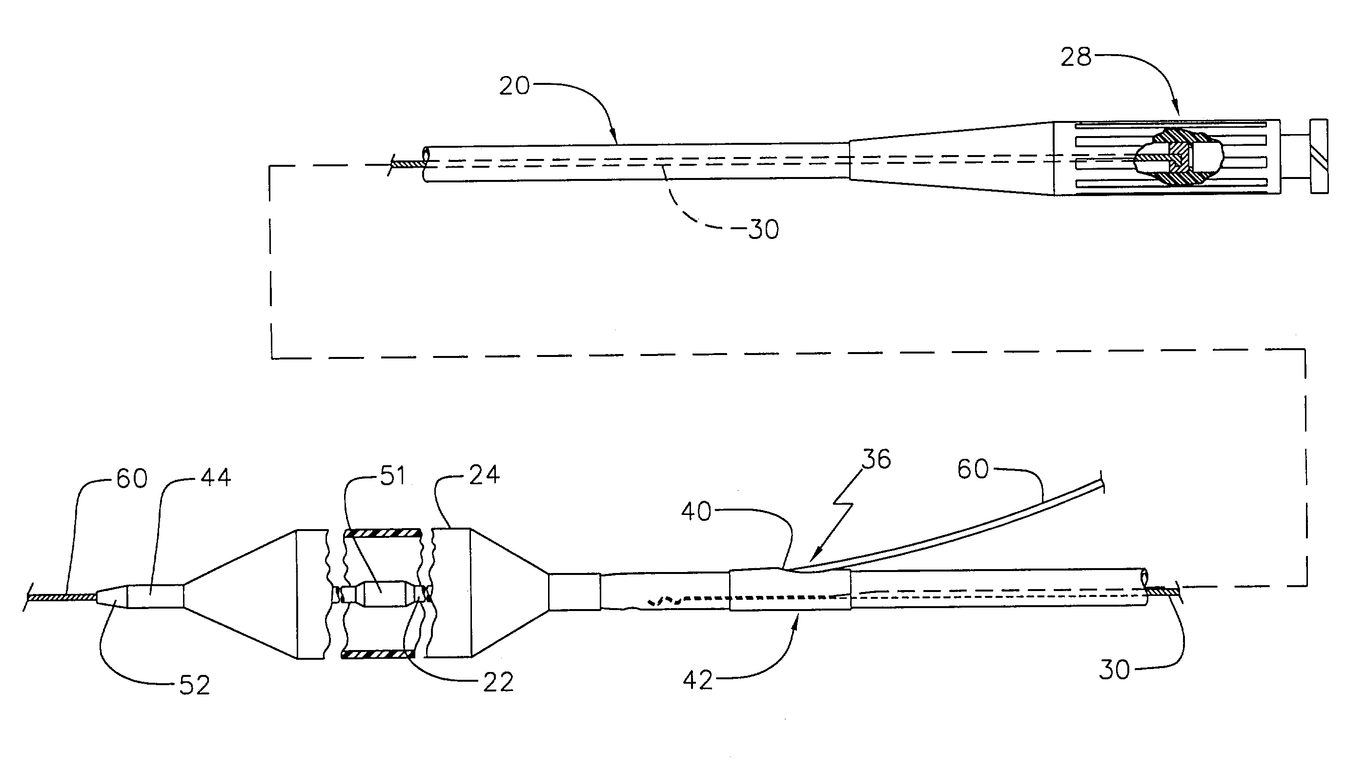 Reinforced monorail balloon catheter