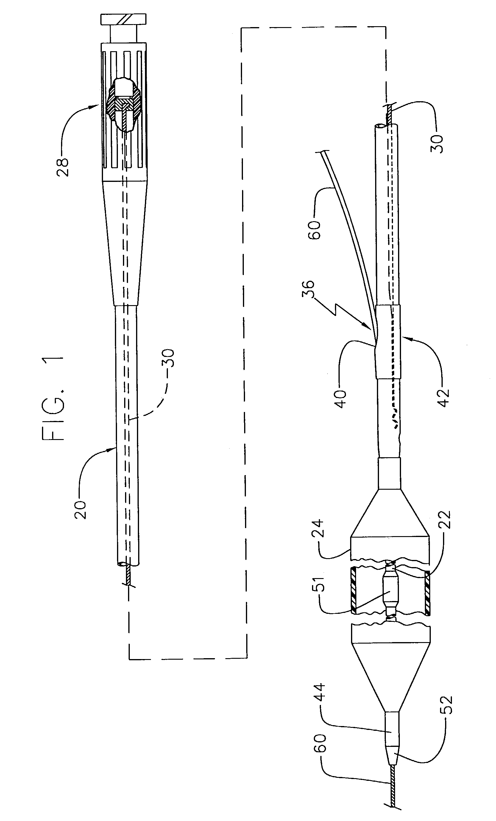 Reinforced monorail balloon catheter