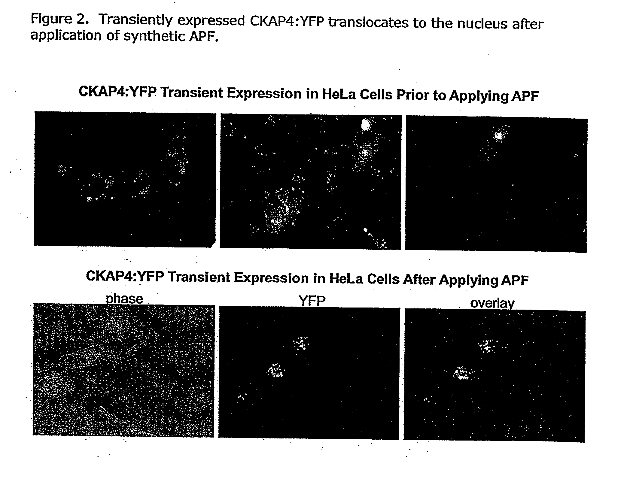 Cell-based  detection of apf through its interaction with ckap4 for diagnosis of interstitial cystitis