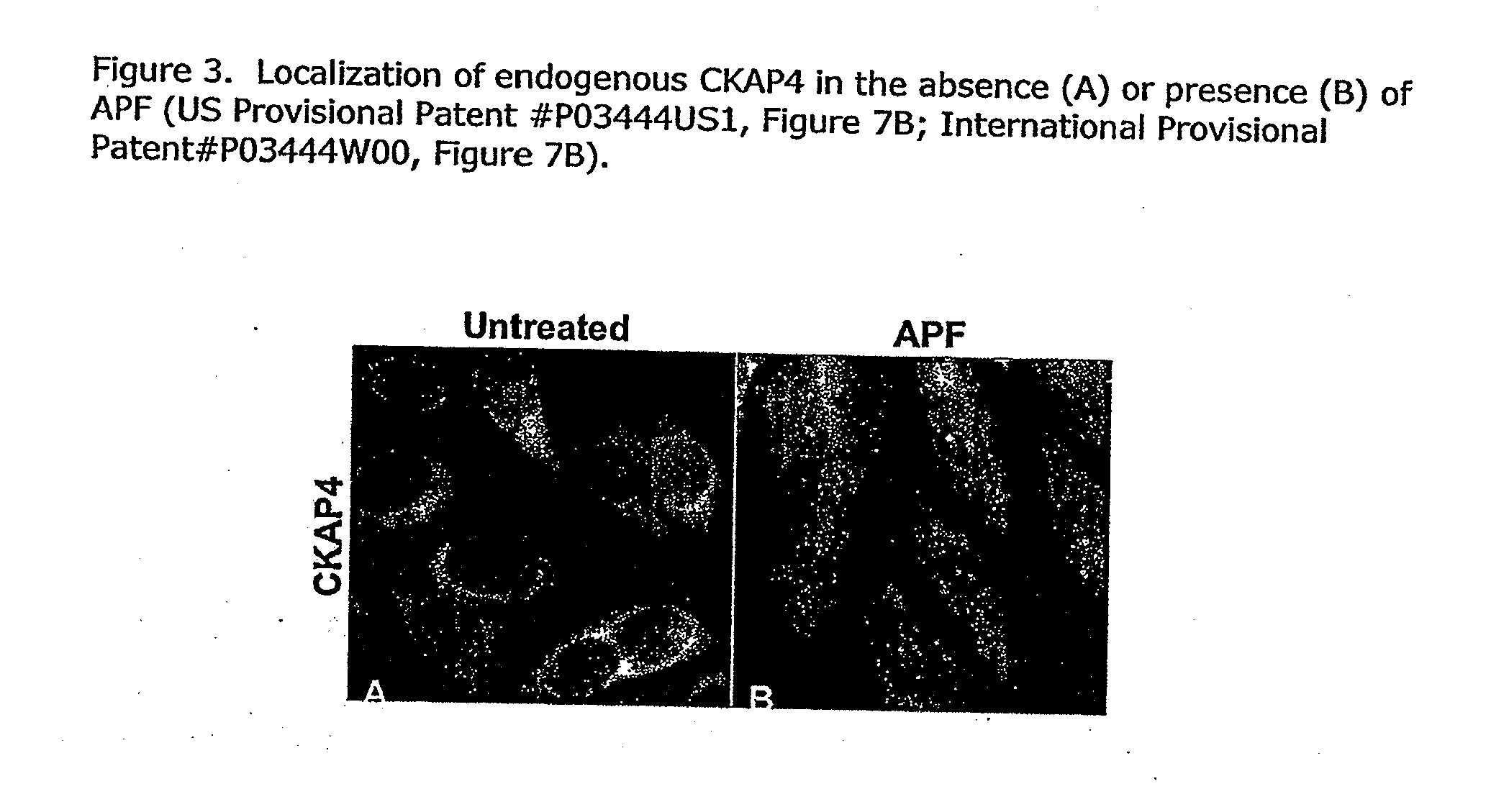 Cell-based  detection of apf through its interaction with ckap4 for diagnosis of interstitial cystitis