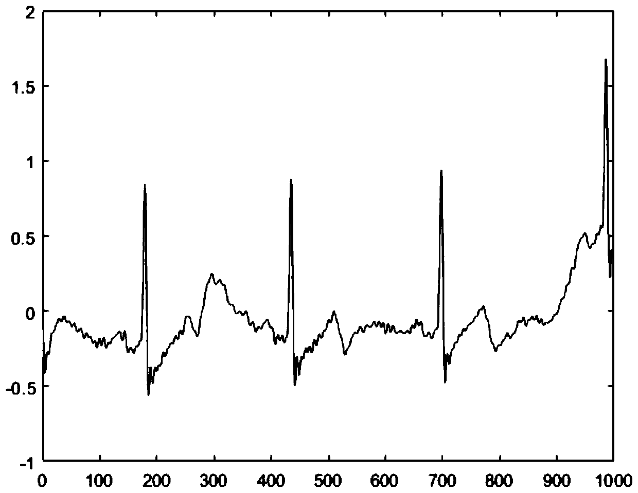 Electrocardiosignal analysis method based on deep learning