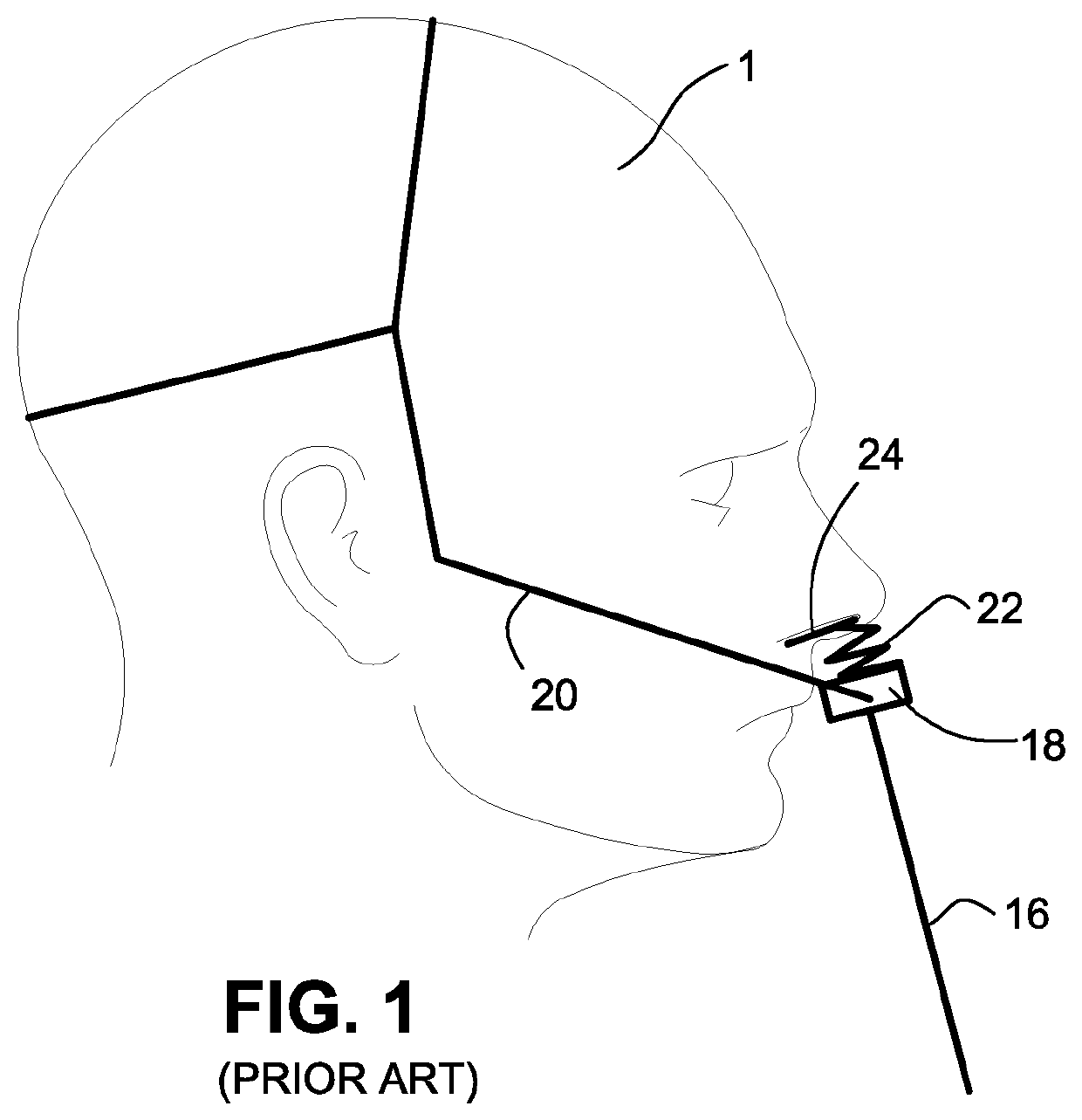 Patient interface systems