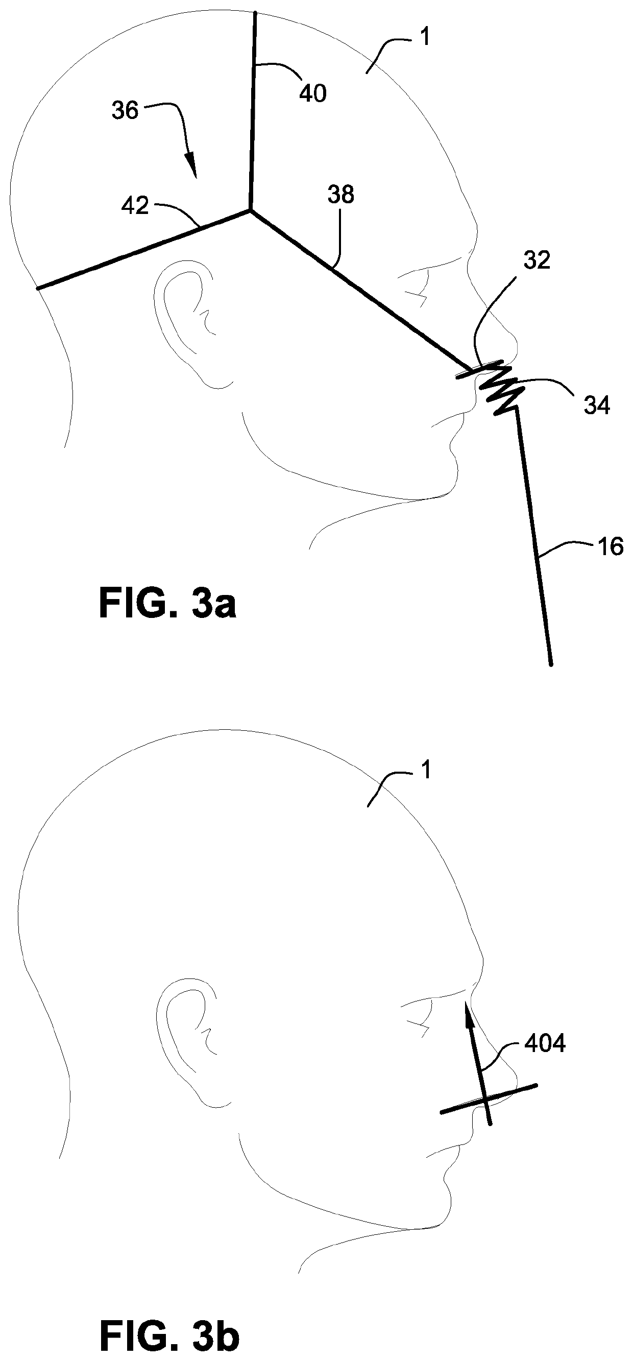 Patient interface systems