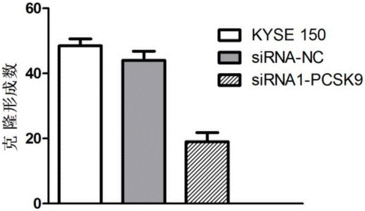 Application of PCSK9 in diagnosis and treatment of esophageal squamous carcinoma