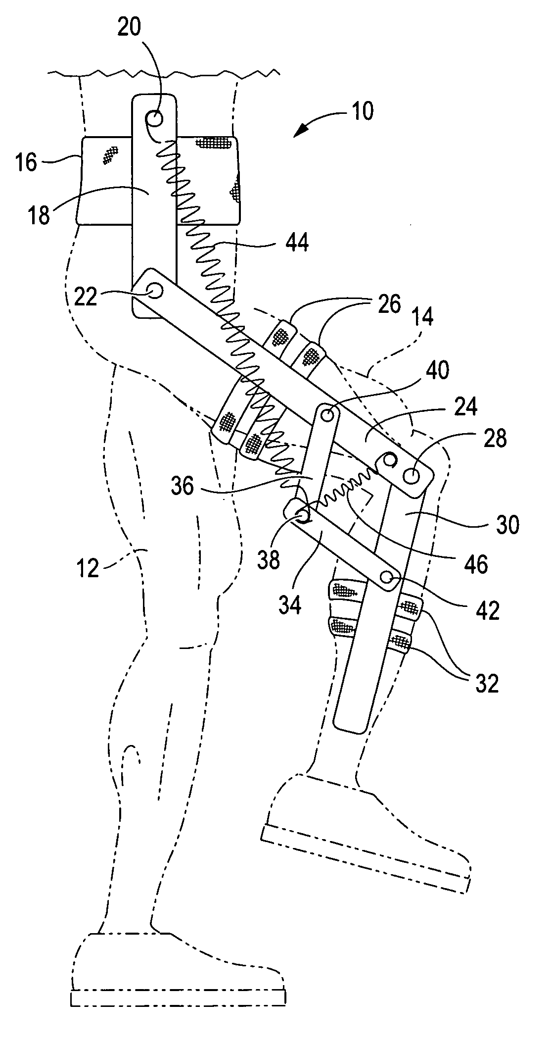 Gravity balanced orthosis apparatus