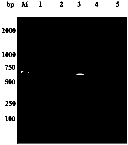 Stably expressed anti-interferon gamma genetically engineered single-chain antibody strain and application