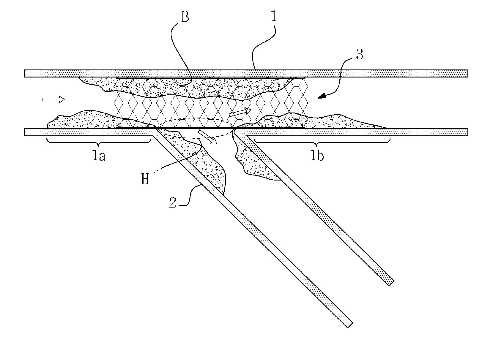 Stent for Protecting Bifurcated Blood Vessels in Bifurcation Lesion