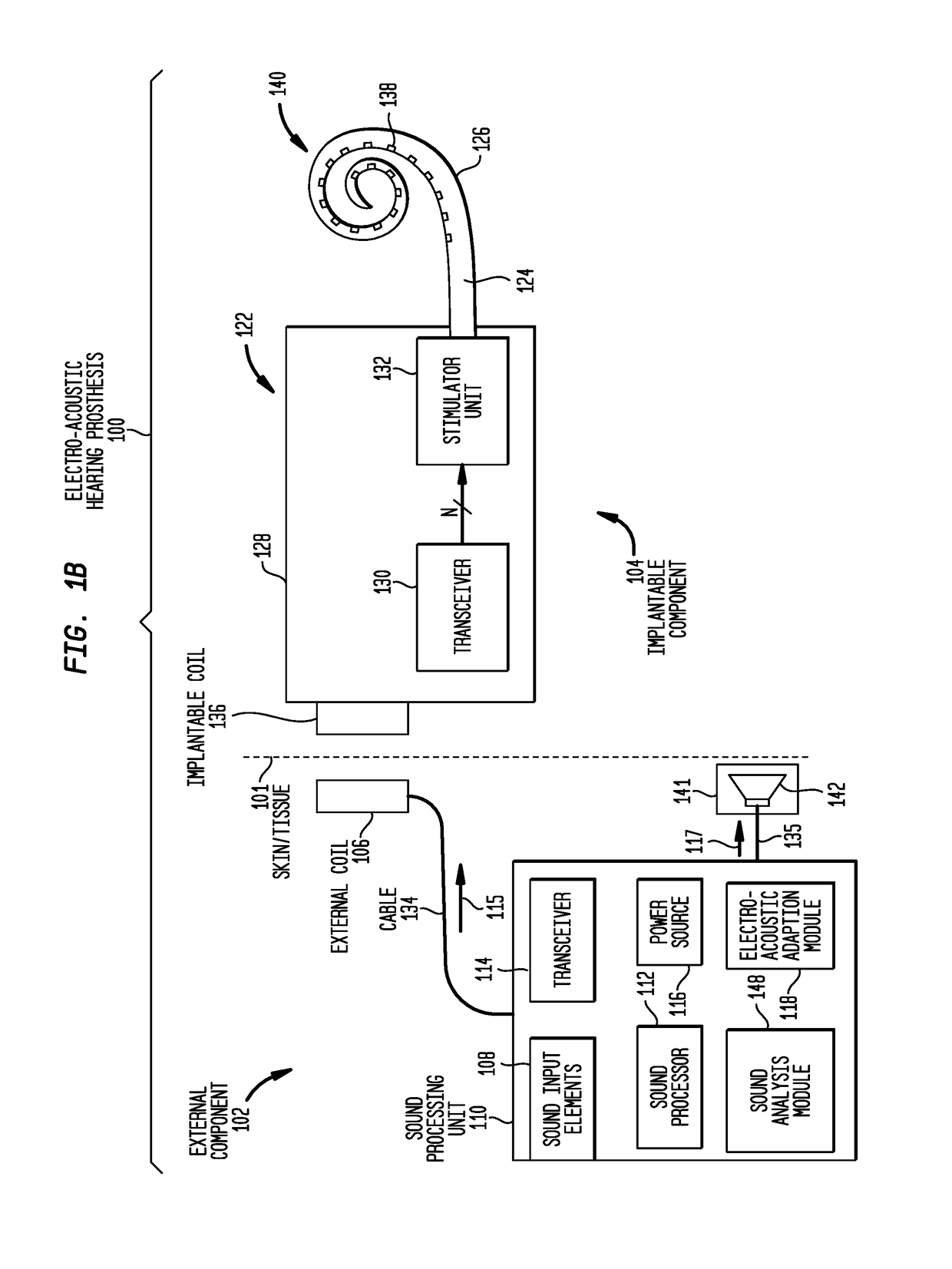 Electro-acoustic adaption in a hearing prosthesis