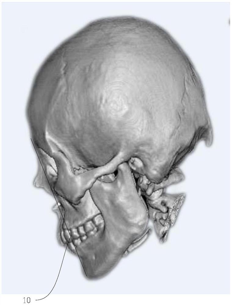 Skull correction information acquisition method, storage medium and electronic equipment