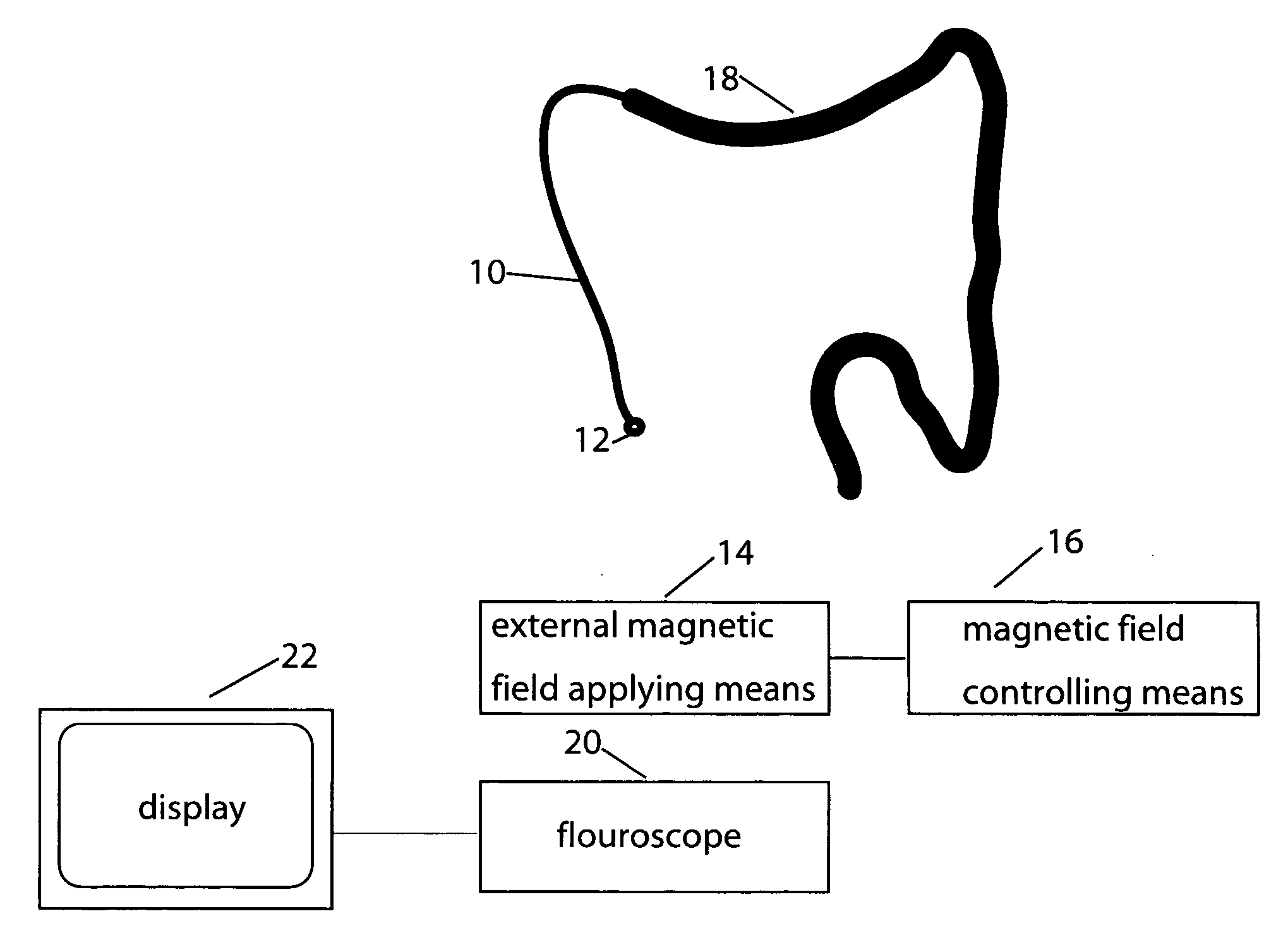 Magnetically guided colonoscope