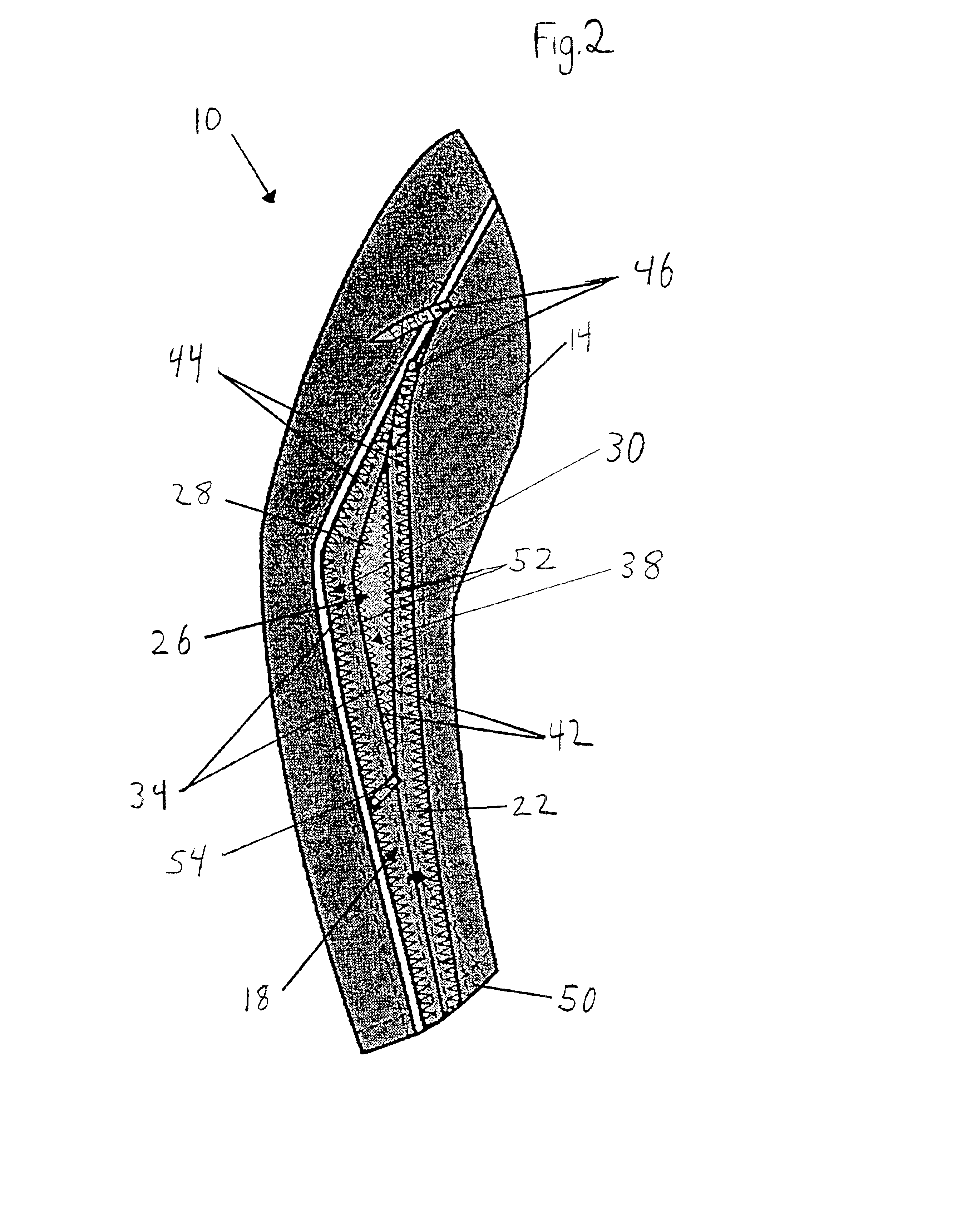 Garment ventilation system