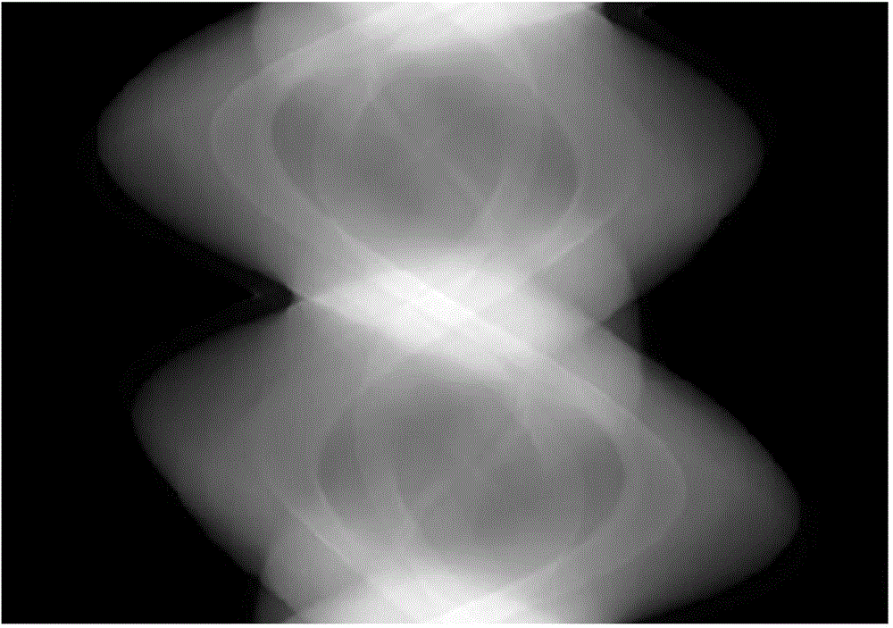 Sparse angle CT image reconstruction method based on gamma prior