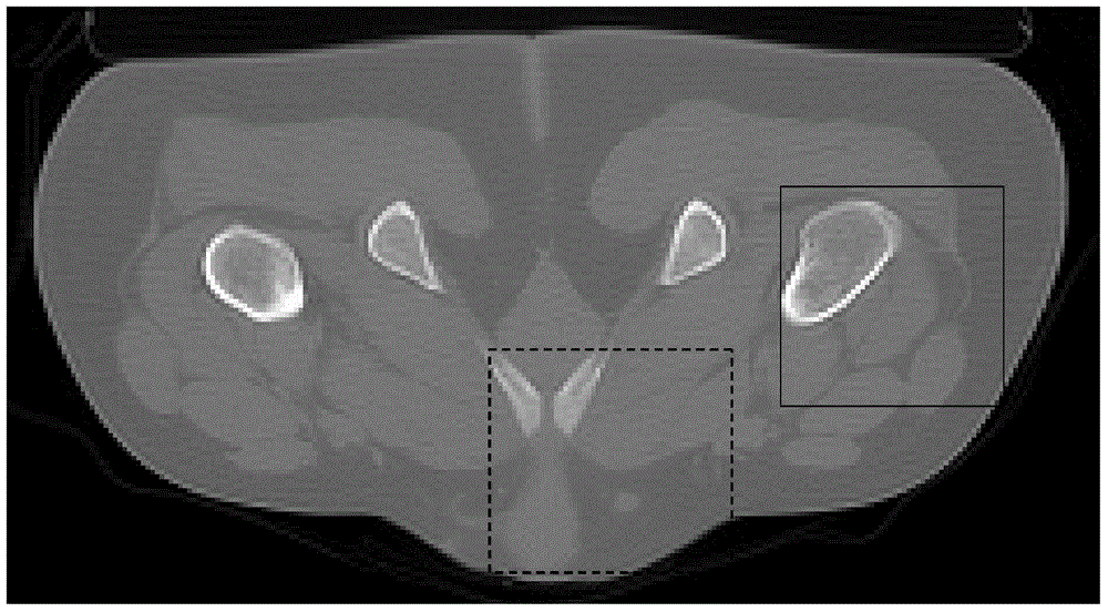 Sparse angle CT image reconstruction method based on gamma prior