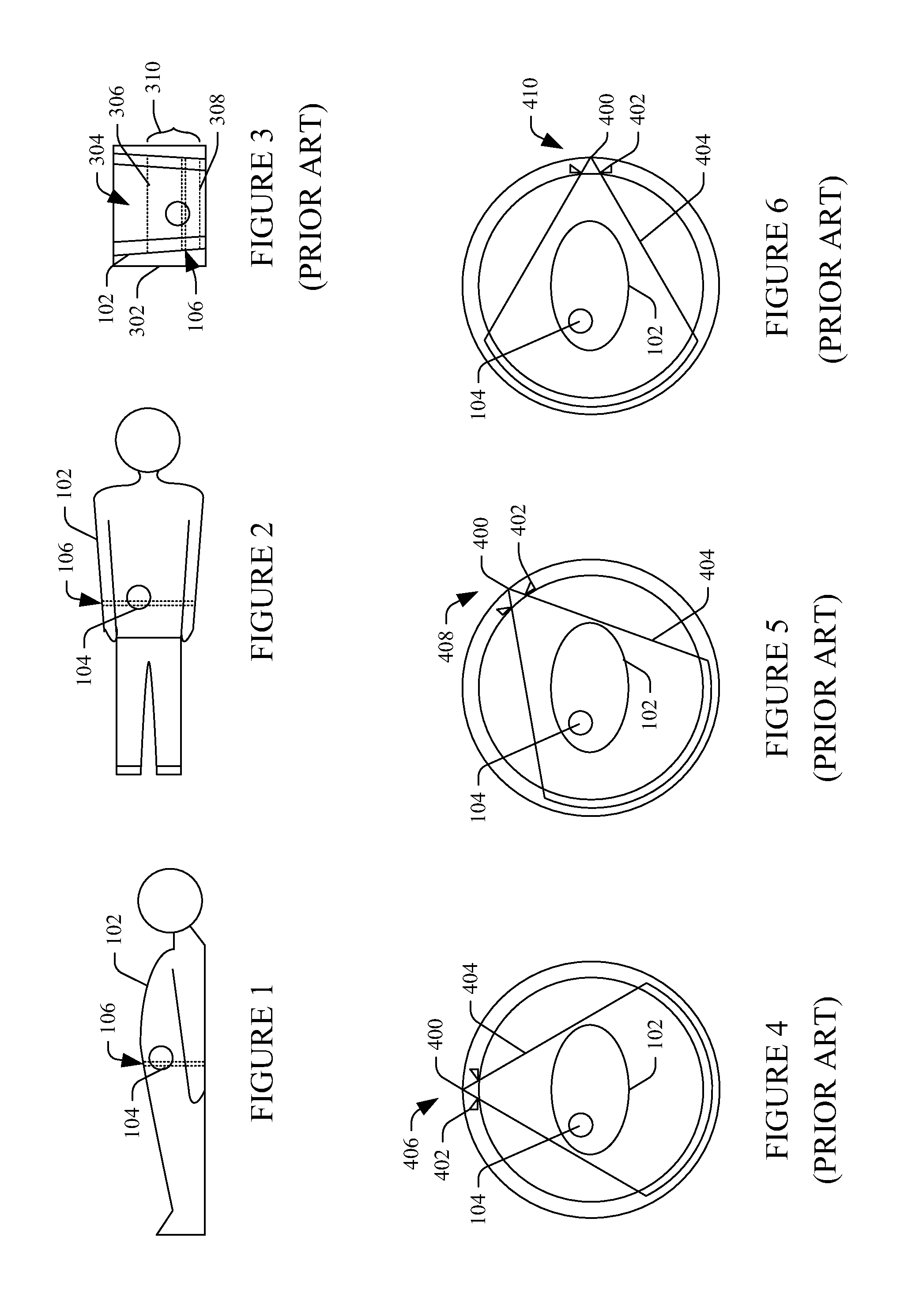 Dynamic collimation