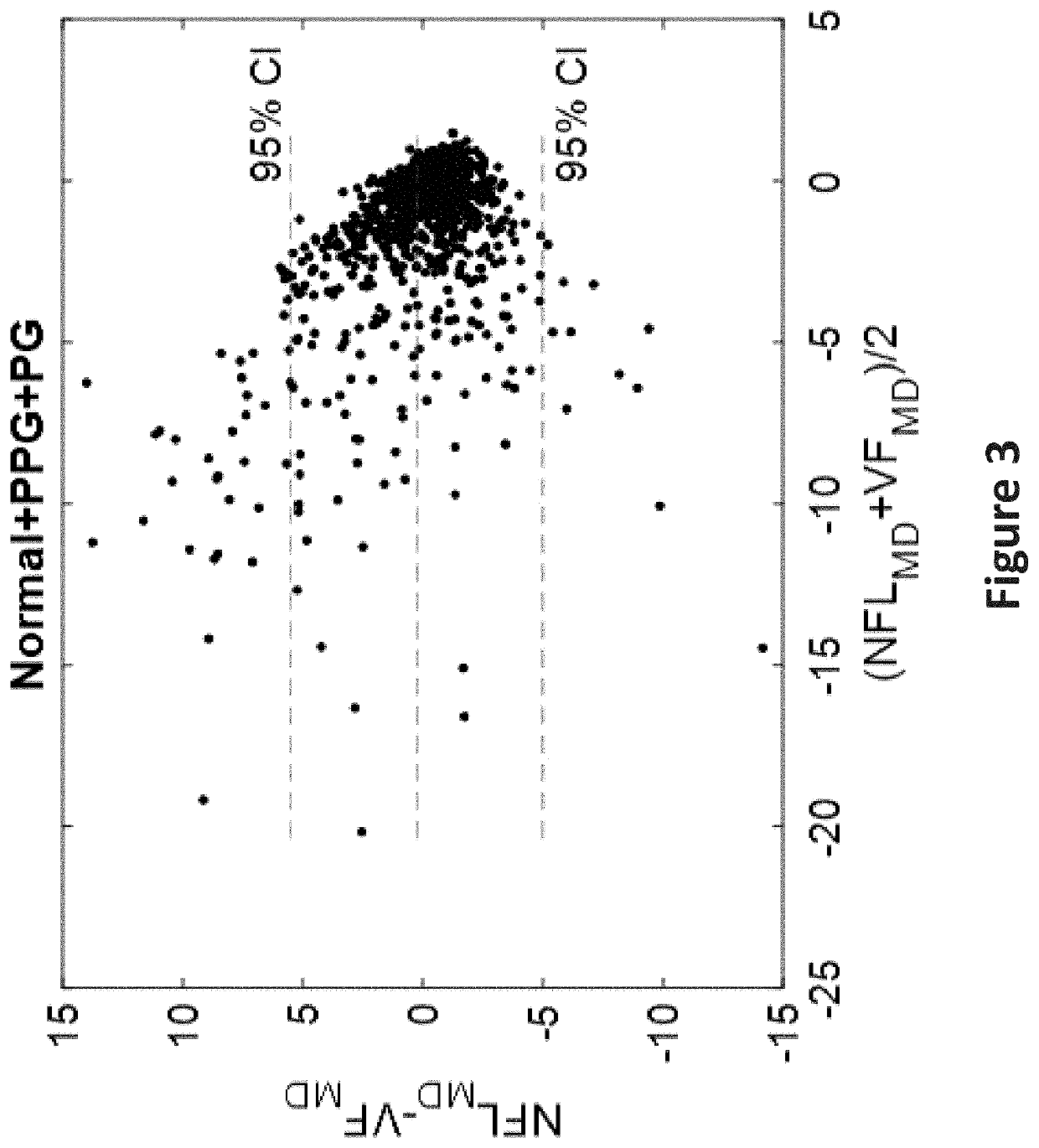 Visual field simulation using optical coherence tomography and optical coherence tomographic angiography