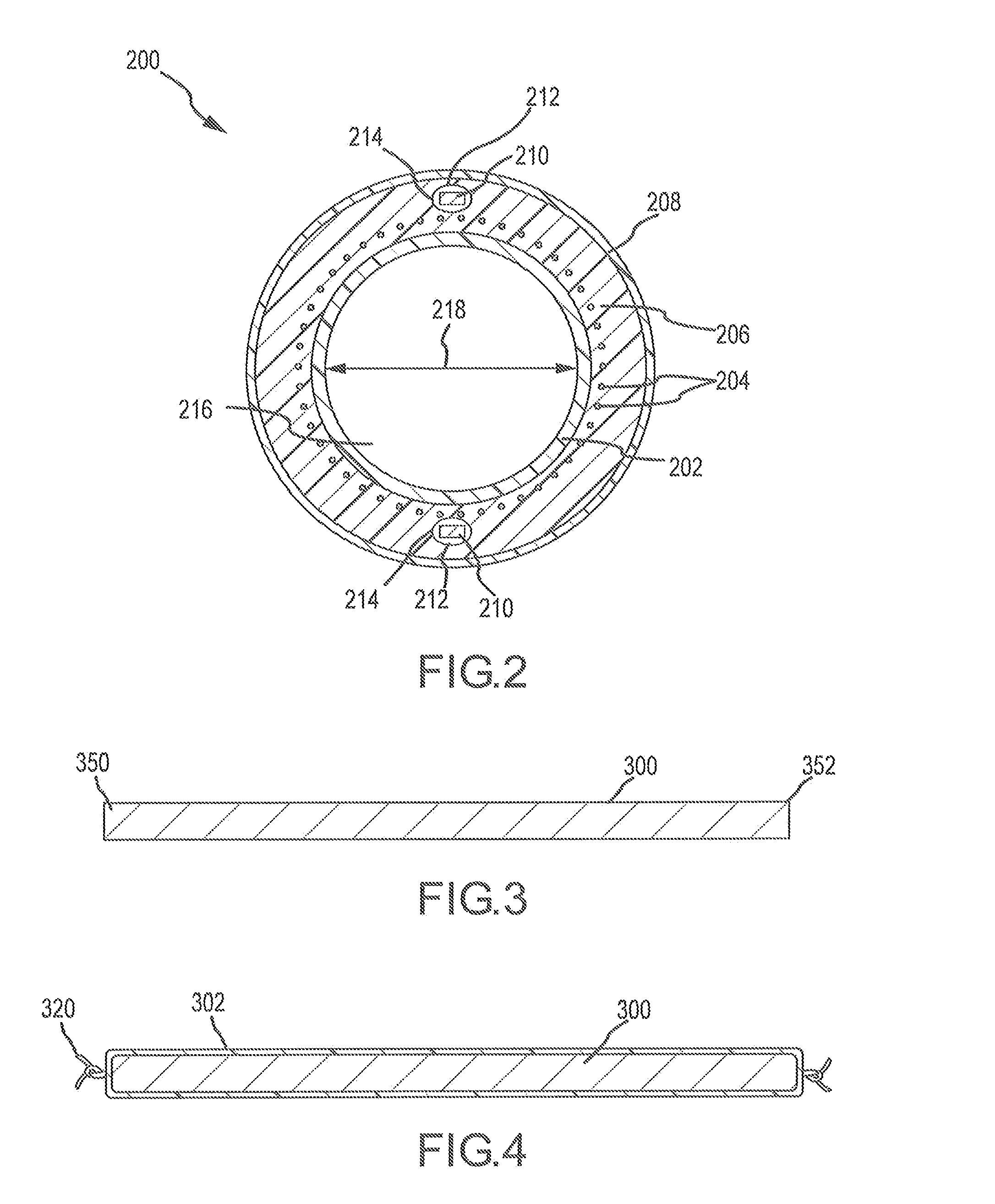 Catheter and introducer catheter having torque transfer layer and method of manufacture