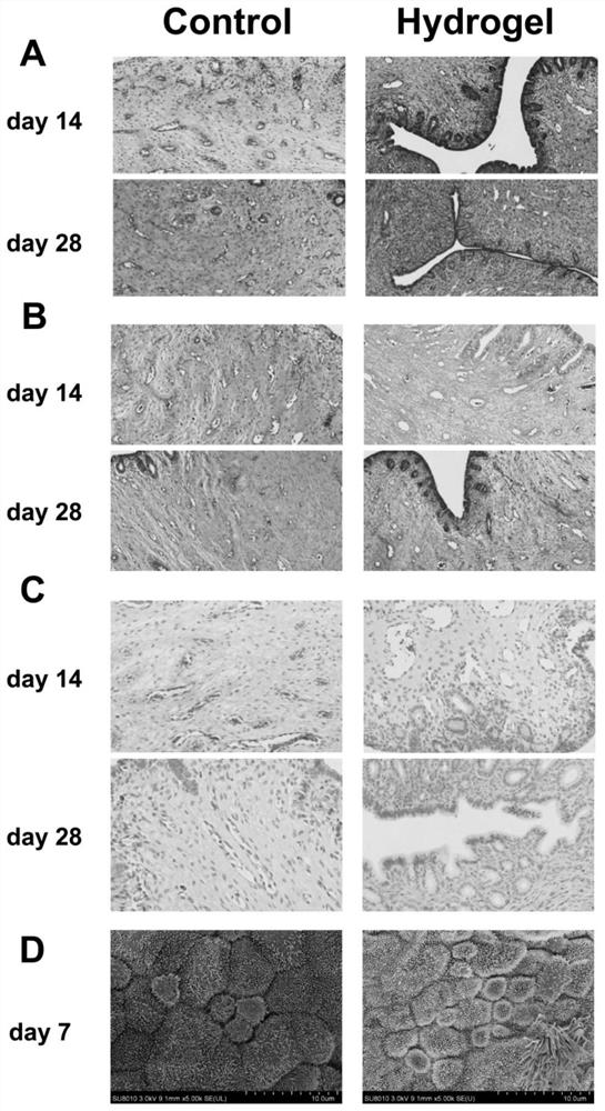 Preparation and application of placenta acellular matrix gel loaded with living cells