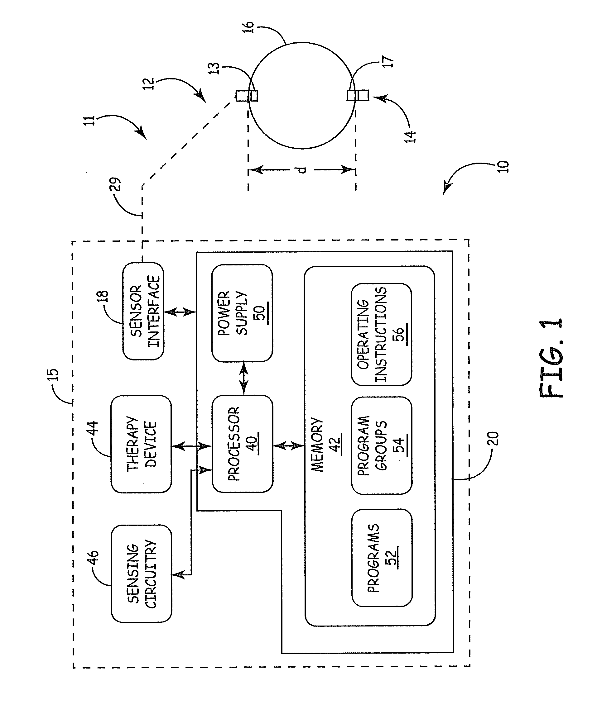 Distance measurement using implantable acoustic transducers