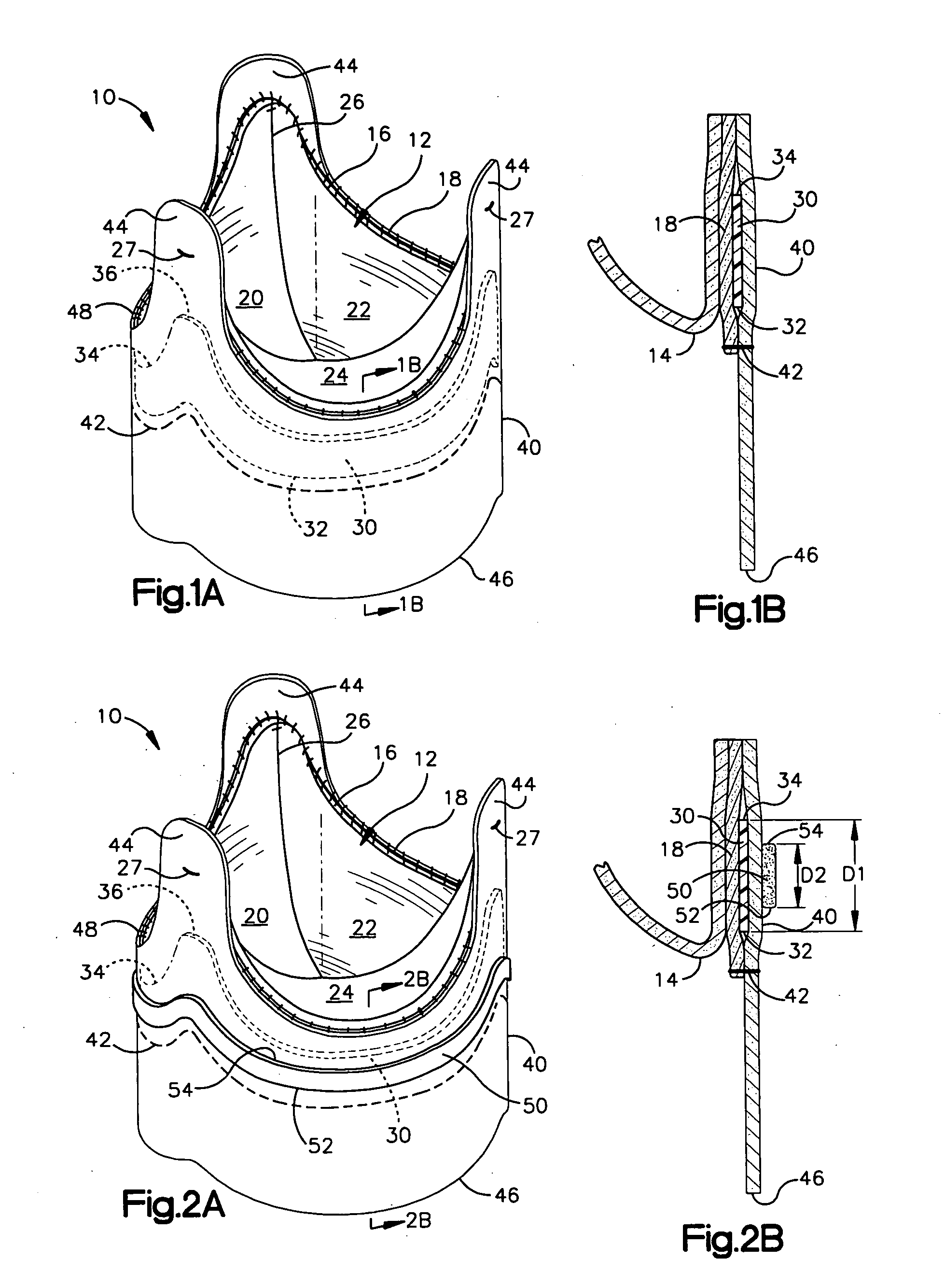 Low profile heart valve prosthesis