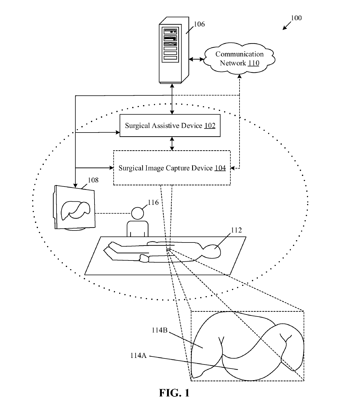 Co-localization of multiple internal organs based on images obtained during surgery