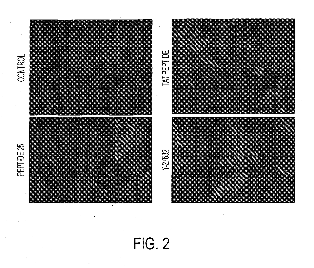 Rho associated kinase (ROCK) inhibitors and their use in treating disease