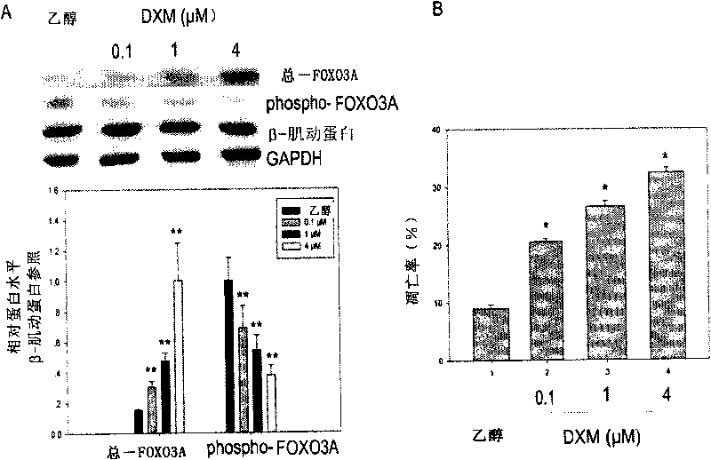 Action target spot of glucocorticoid and application thereof