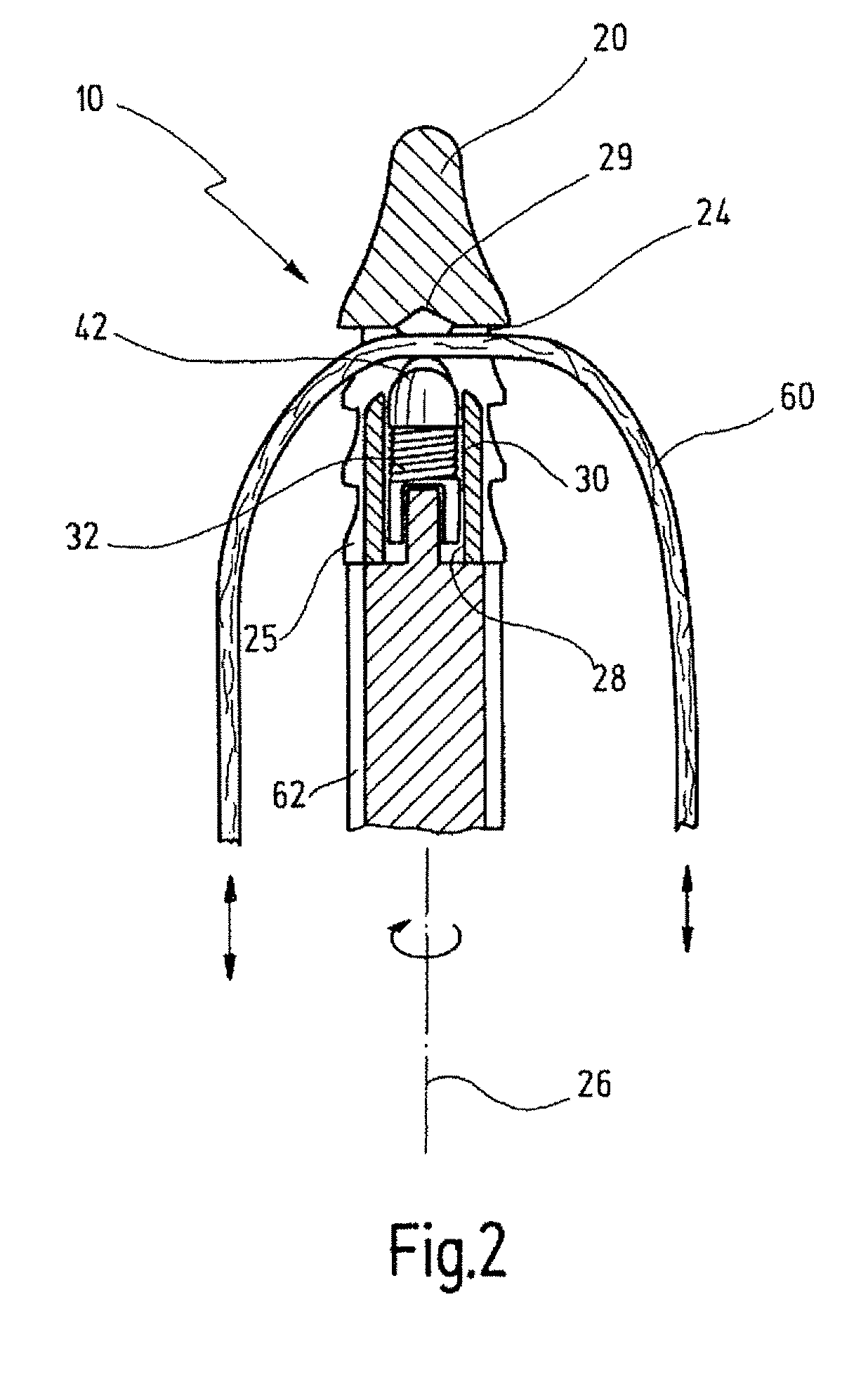 Anchor Element For Knotless Fixing Of Tissue To A Bone