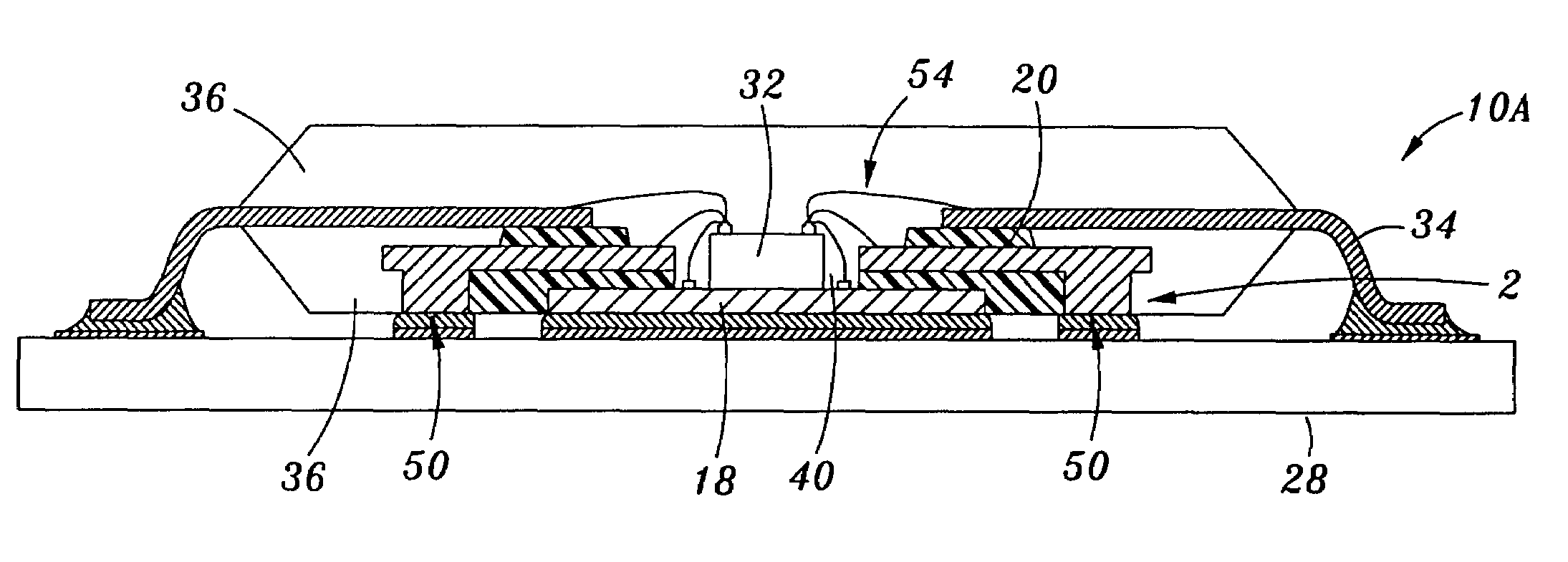 Exposed lead interposer leadframe package