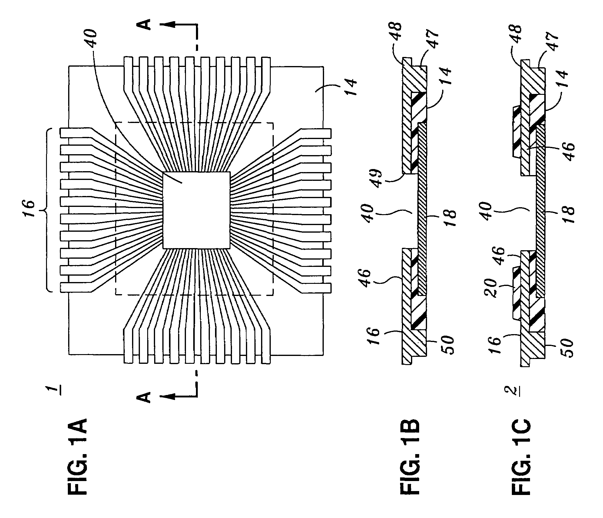 Exposed lead interposer leadframe package