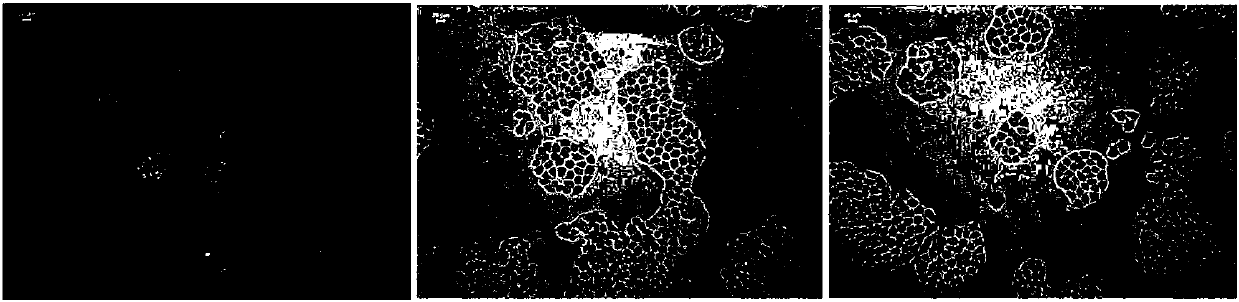 Method for building overexpression MGST1 gene human lung adenocarcinoma cells and application thereof