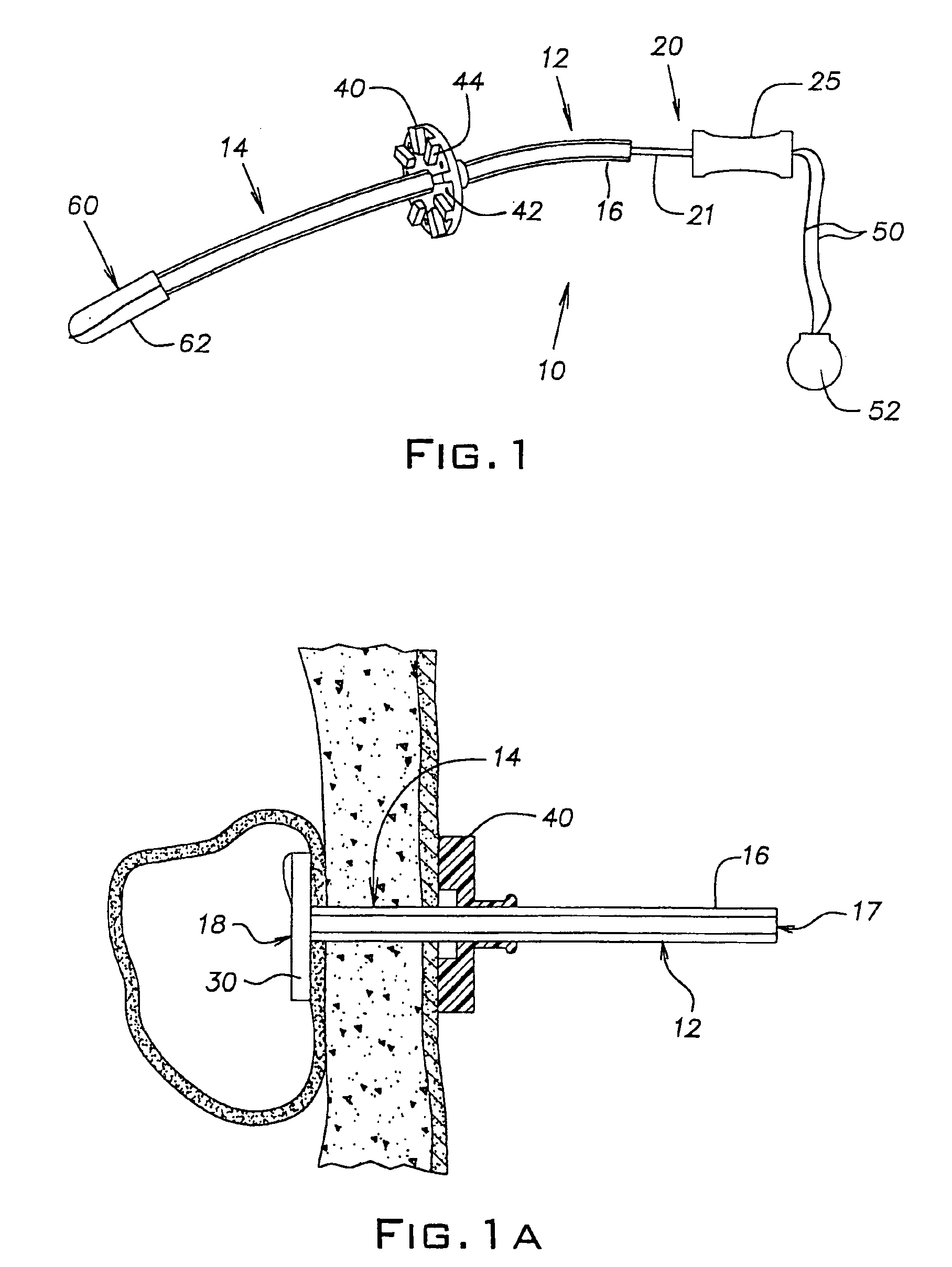 Gastrostomy device package and method of assembly