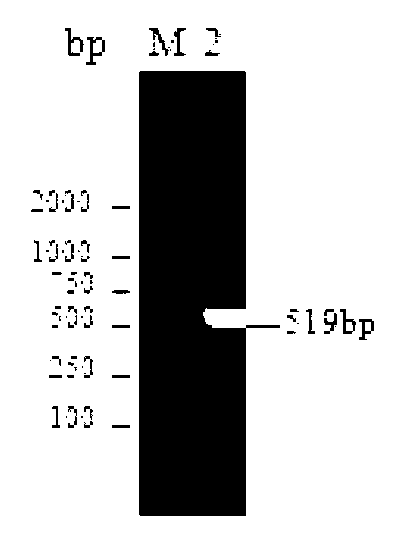 Construction and expression for campylobacter jejuni cytolethaldistending toxin expression vectors, and preparation for monoclonal antibody