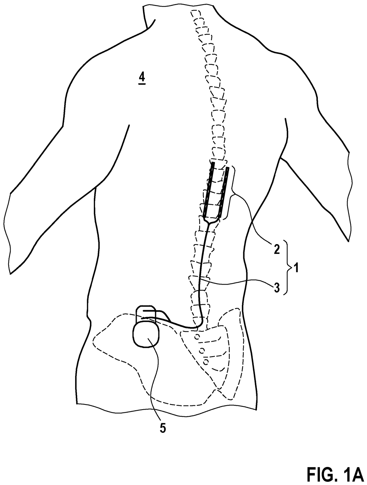 EP4479127B1 patent drawing