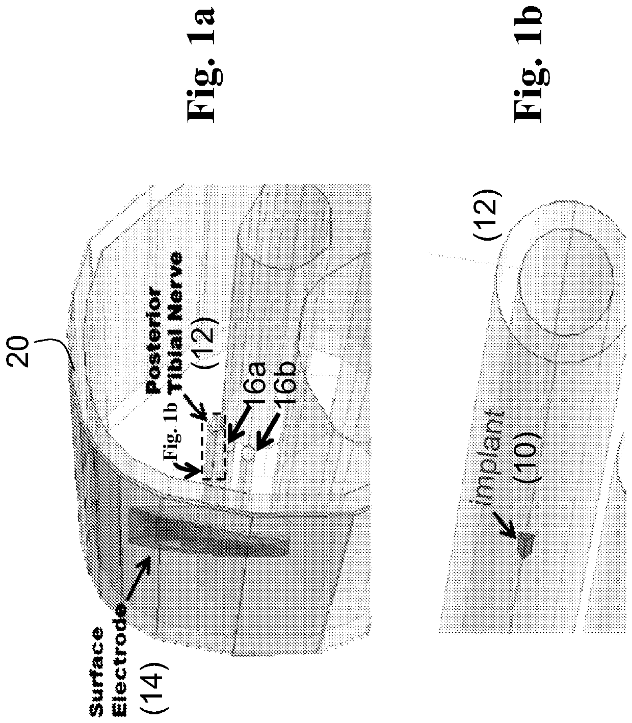 EP3950048A1 patent drawing